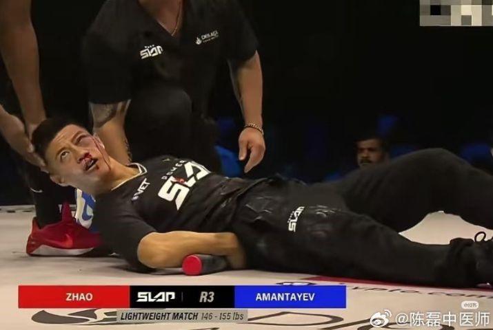 大陸通背拳傳人趙鴻剛「耳光力量」大賽遭KO　醫界質疑安全性