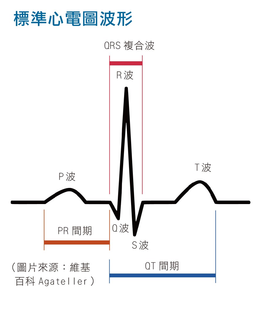 圖為標準心電圖波形。