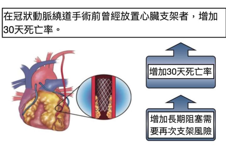   心臟支架增加冠狀動脈繞道手術後，需要再次放置心臟支架機率。圖/長庚醫院提供