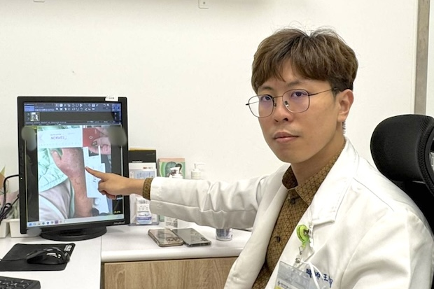 男子被魚刺傷險截肢　高雄秀傳醫院及時救治