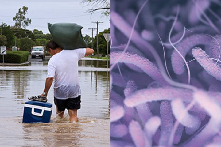 風雨不斷環境惡劣！佛州致命創傷弧菌已13死　專家警告傷口勿碰水